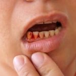 Nằm mơ thấy máu trong miệng là điềm báo gì? Đánh con số nào?